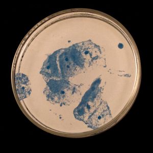 Trichomoniasis One