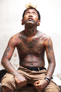 Chapter 3 Tattoo removal