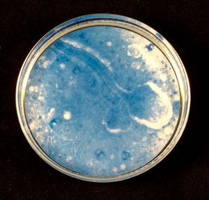 Syphilis Two