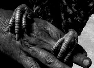 Hand and Feet