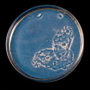 Bacterial vaginosis Two