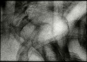 Delusions # 14