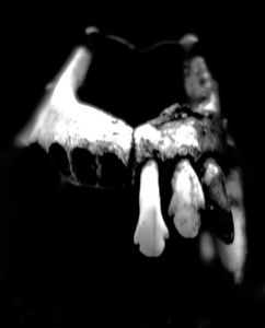 Teeth & Bone