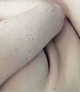 Untitled V (Skin Studies series)