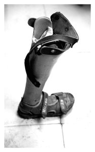 Artificial leg and shoe workshop