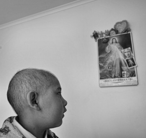 CANCER - CHILDHOOD