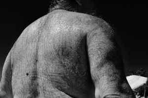 Hairy