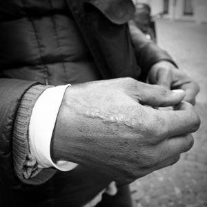 Nigerian man shows his hand with a bullet injury