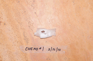 Chemo #1