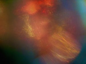 Vestige