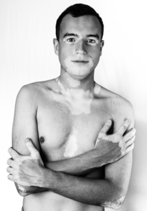 Lukas A.