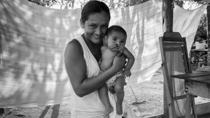 Operation Smile