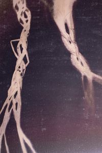 Act I - Braids