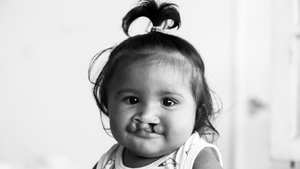 Operation Smile