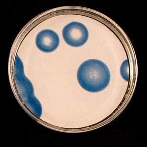 Gonorrhea Two