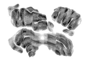 Closed fists