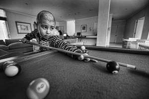 CANCER - CHILDHOOD