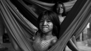 Operation Smile