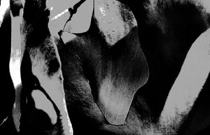 Metamorphosis 66