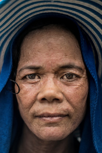 Om Chovy 50 from Kandal Province has been working in construction for the last 5 years. Chovy has a serious infection in her foot that she believes was caused by cement that she was mixing whilst wearing just sandals.