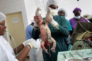 Sierra Leone Delivery