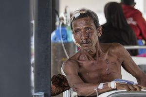 An earthquake survivor, M. Jaafar M. Sabi, 63 years old, receives medical treatment at the makeshift hospital in Pidie Jaya, Aceh province, on December 9, 2016.