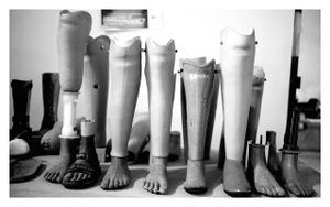 Artificial leg and shoe workshop