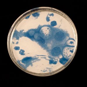 Chlamydia One