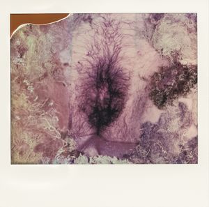Vulva 3