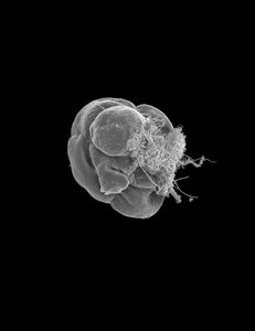 Aurelia Immortal (Polyp phase).