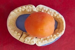 teeth and apricot