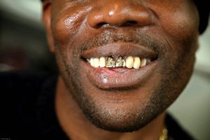 A prisoner shows off his gold teeth with crosses engraved in them.HMP Coldingley, Surrey was built in 1969 and is a Category C training prison. Coldingley is focused on the resettlement of prisoners and all prisoners must work a full working week within the prison. Its capacity is 390 prisoners.