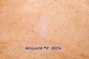 Neulasta #5