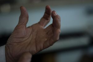 Darren's fingers