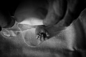 © Christian Werner - Iraq, Basra, 22 April 2012 – Detail image of a hand of a stillborn baby, while it is wrapped in linen cloth.