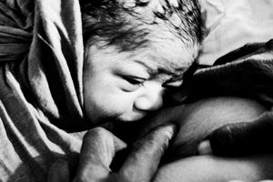 Caesarean 4