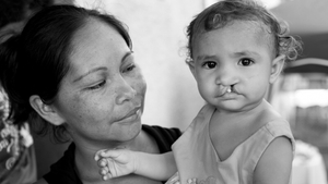 Operation Smile