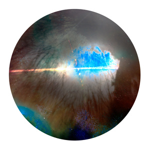 Tin-can Firmament: North 50° 16' 16″, East -05° 10′ 91″ (06/03/15 - 23/03/15)
