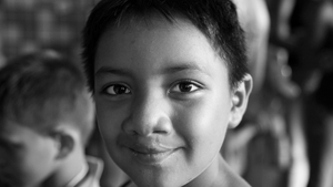 Operation Smile