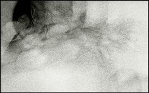 Delusions # 15