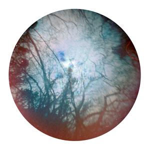 Tin-can Firmament: North 50° 16' 62″, East -05° 10′ 97″ (13/03/15 - 13/04/15)