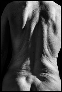 Antique Skin 9