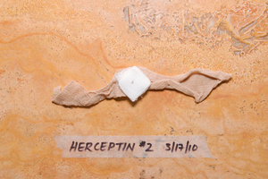 Herceptin #2