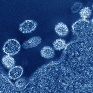 N1H1 Virus