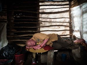 African albino in his self-made hut in the Usambara mountains of Tanzania