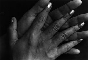1・9・4・7#61, 1988-1989 © Miyako Ishiuchi, The Third Gallery Aya