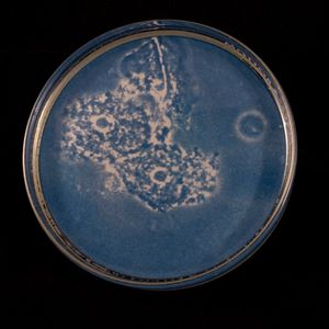 Bacterial vaginosis One