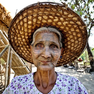 Chin Woman