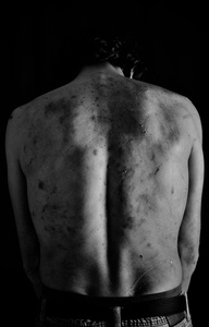 lashes traces