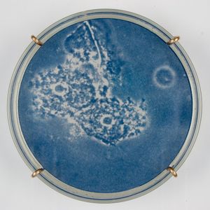 Bacterial vaginosis (detail)